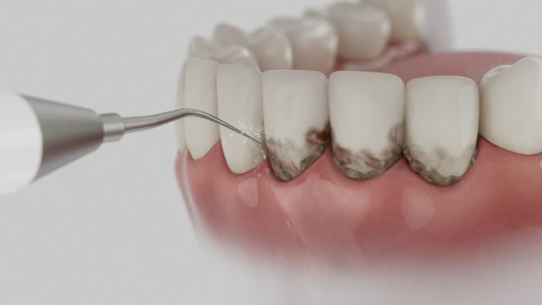 Reliable Dental contractor in Blackhawk, CA by Smile Center Dentistry